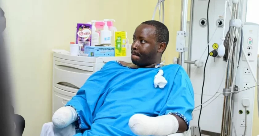 Police Officer Who Lost Both Arms in Teargas Explosion Recounts His Ordeal